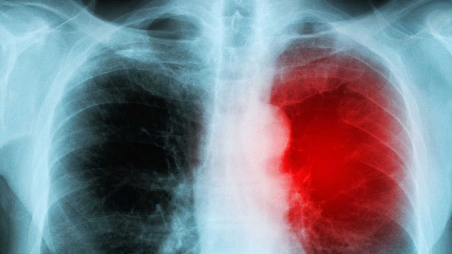 Foto: Blue and Yellow / Canva