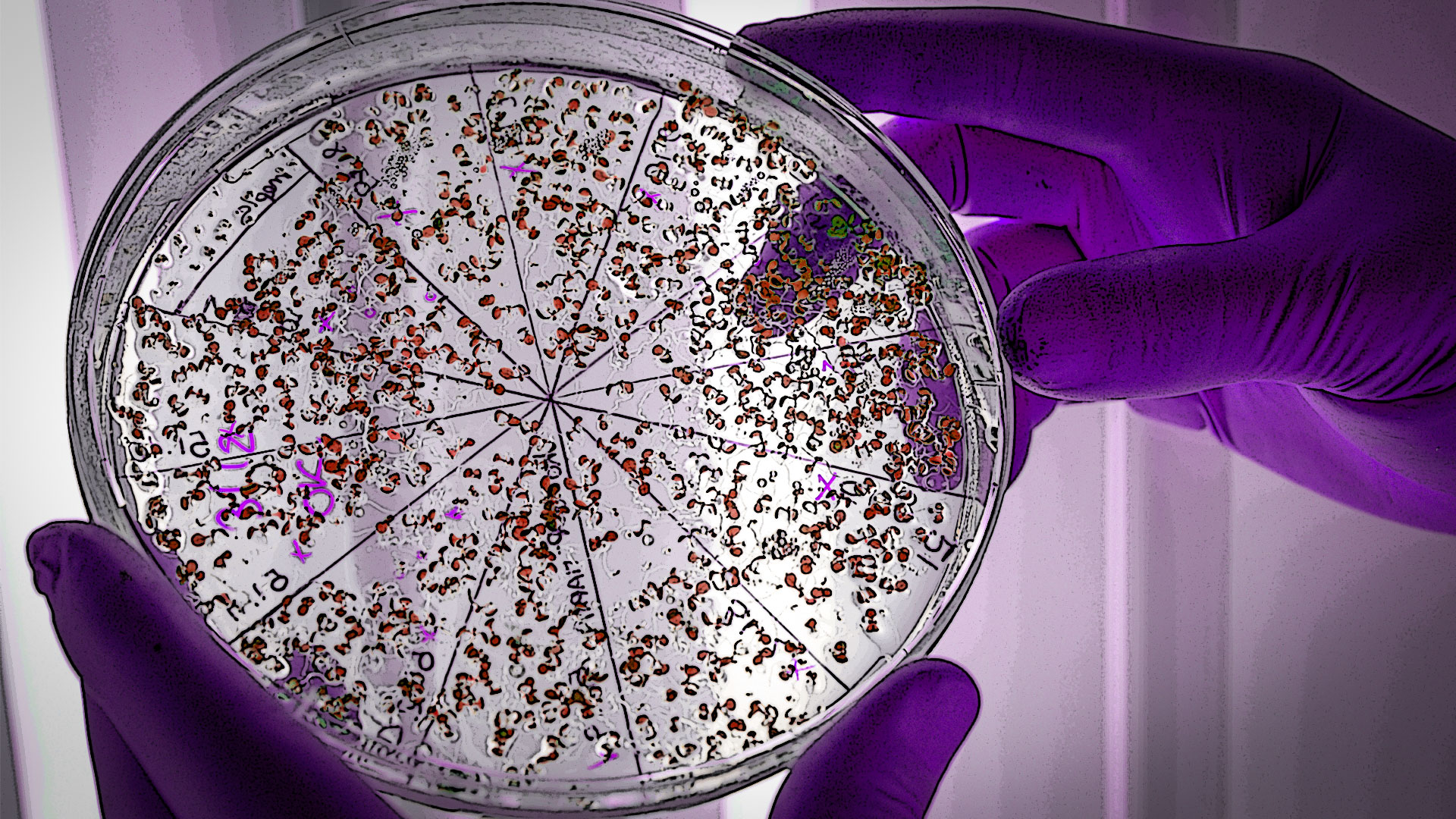 De las bacterias presentes en nuestro cuerpo, la mayor concentración de bacterias las tenemos en nuestra flora intestinal. Foto: especial.