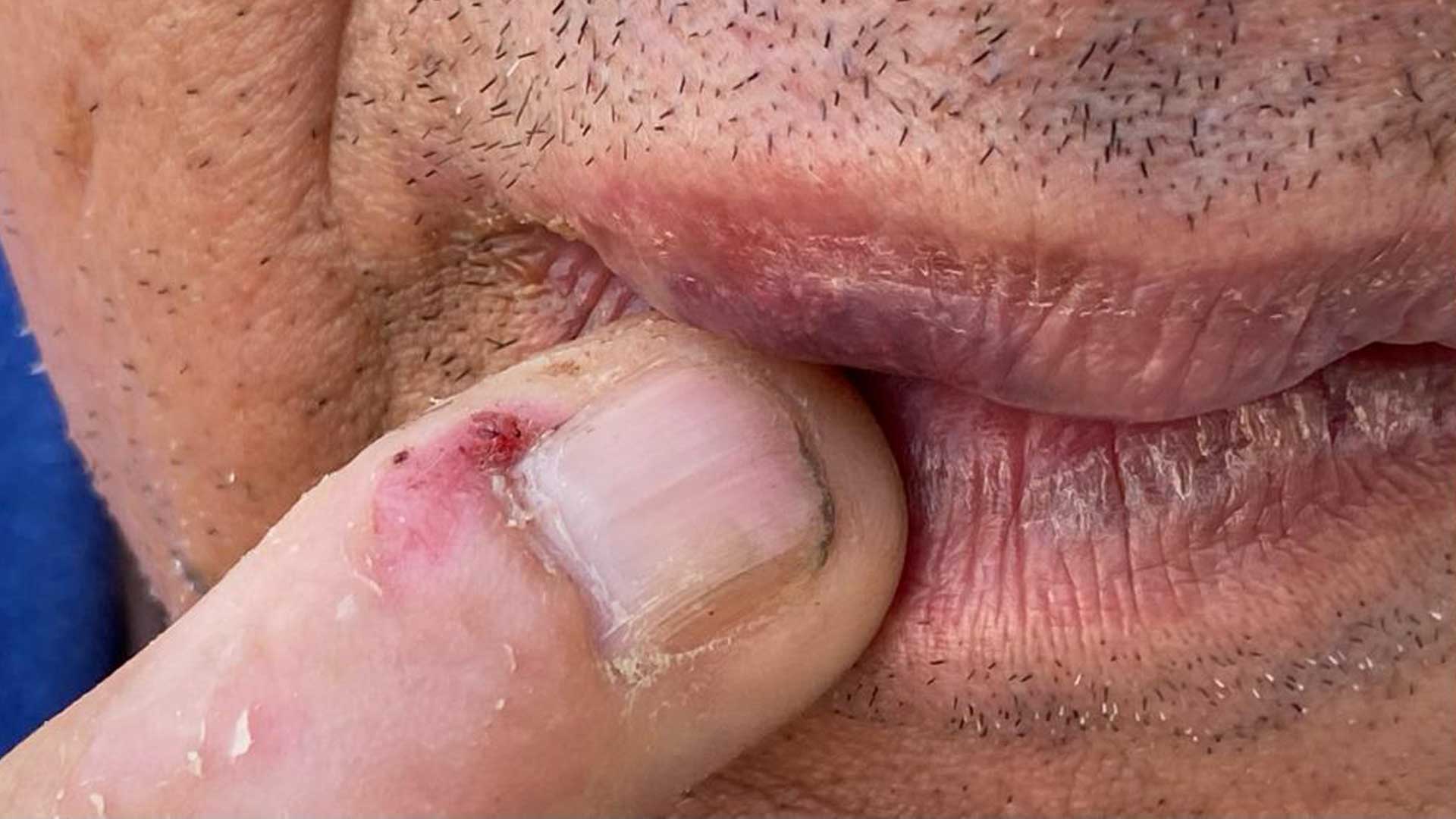 Los golpes que recibió el reportero ocasionó que quedara inconsciente por unos segundos. Fotografías Edith Domínguez